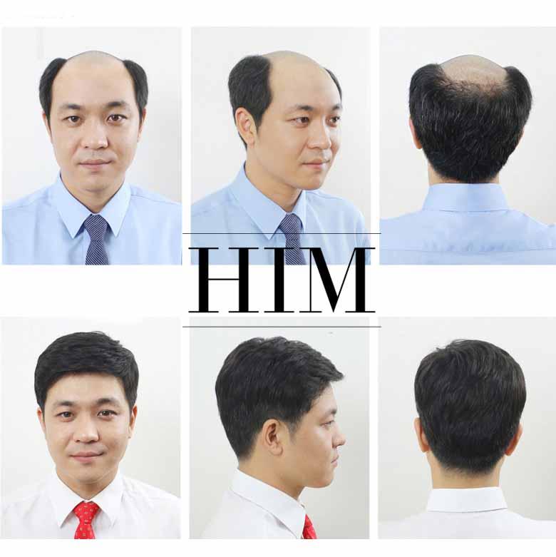 Top 6 địa chỉ bán tóc giả nam cao cấp ở Hà Nội  Tóc giả LUXY